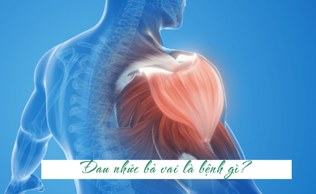 đau bả vai