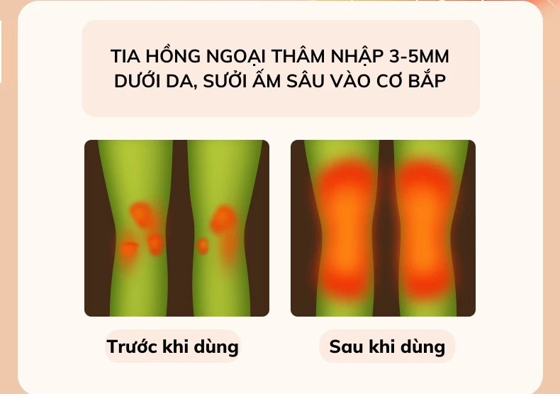 Nhiệt nóng của Máy Massage Khớp Gối DELAX MDG02