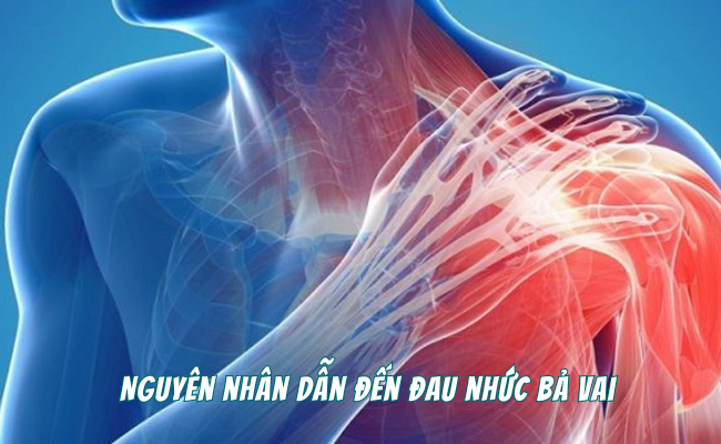 đau bả vai